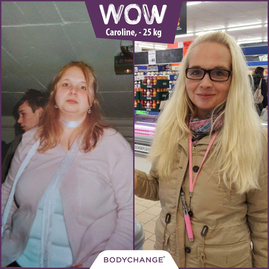 Caroline im Vorher Nachher Vergleich